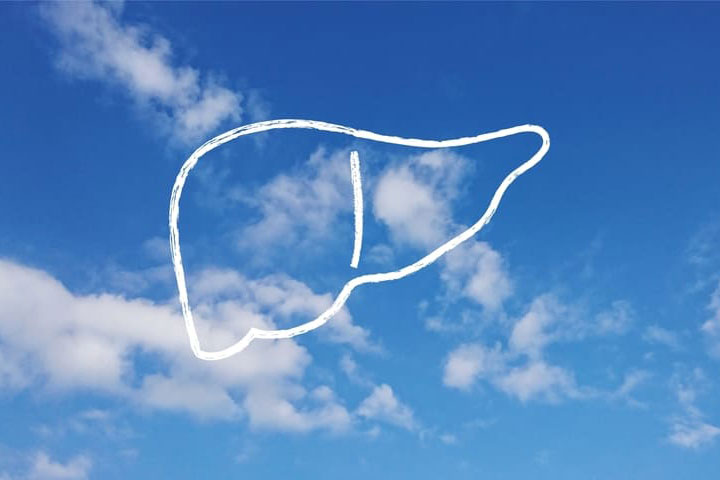 肝硬変