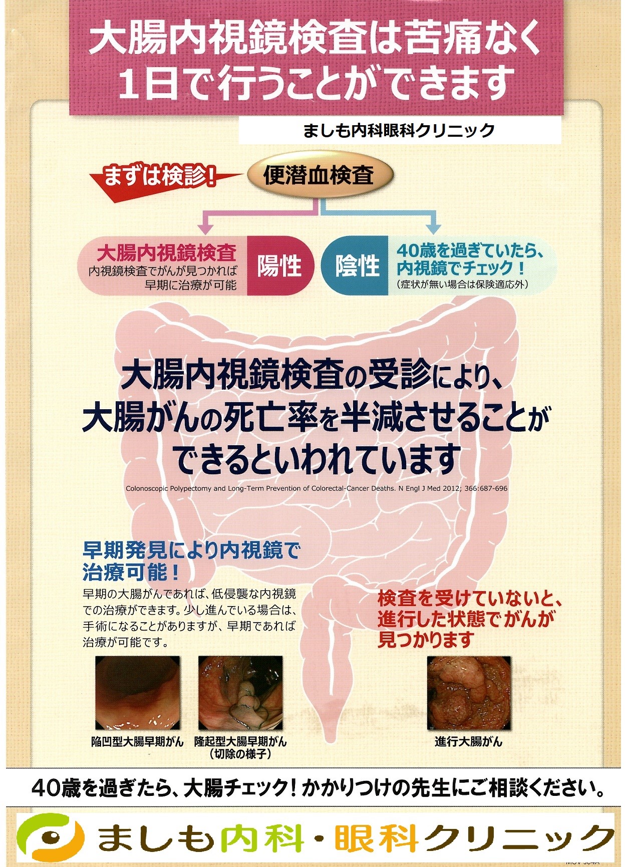 便潜血検査をうけましょう! 内視鏡・堺【ましも内科・眼科クリニック】胃カメラ・大腸カメラ 便潜血検査をうけましょう! 内視鏡・堺【ましも内科・眼科クリニック】胃カメラ・大腸カメラ